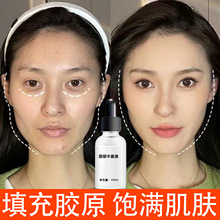 �沿��ӯҺ��̫��Ѩ�ṵ���齺ԭ���ױ���������侫��Һ��������