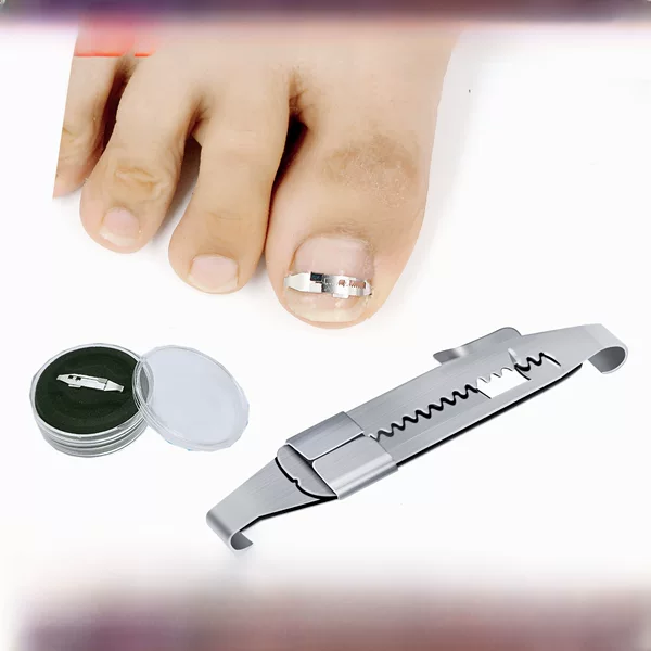 Fanzhuang male inlaid nail nail buckle nail stick roll nail correction nail correction device toenail pull stick knife pliers