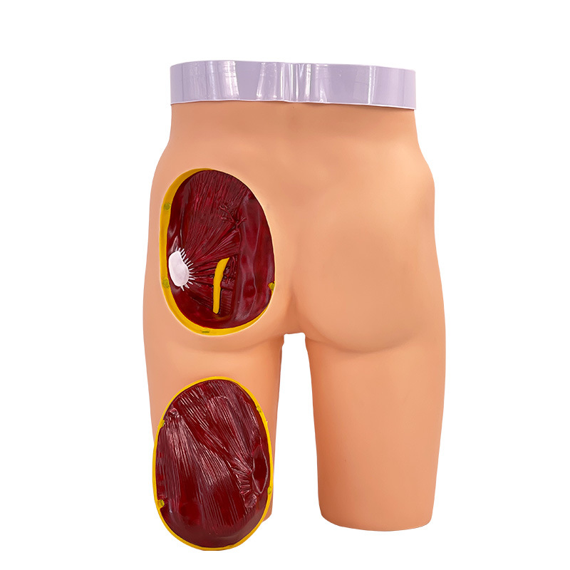 �߼��β�����ע��ģ������ʽṹģ�� �β�ע����ϰģ�� ҽѧѵ��