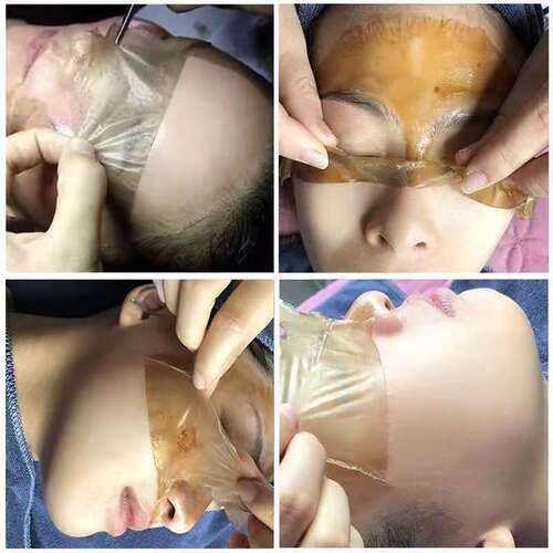 Five-day beauty salon spot removal and skin brightening spot treatment, peel-off mask for removing dark spots and blackheads