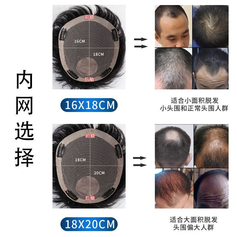 假发男短发真发无痕隐形帅气韩版全真发丝男士假发片补头顶补发男