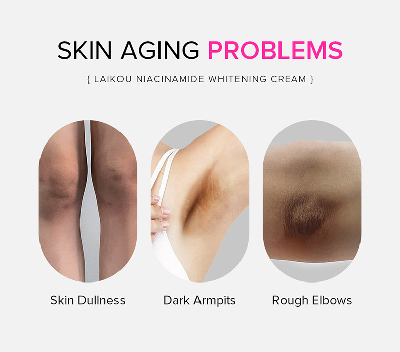 LAIKOU cream 100g Hydrating and moisturizing Underarm Cream Facial skin care products cross-border undefined