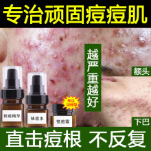 �ݱ��ˮ����A���������ȥ�����۴��]�ڵ���ӡ�����ഺ��