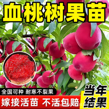 Ѫ�Ҙ����޽ӻ����ϱ�������Ʒ�N�ش��ͺ����������ͥԺ�Nֲ��