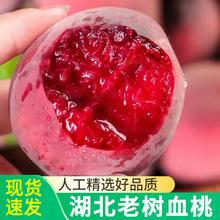 �����Ϙ�Ѫ�����r����ˮ���Fժ����5��t��ë�ҕr���ЋD��������