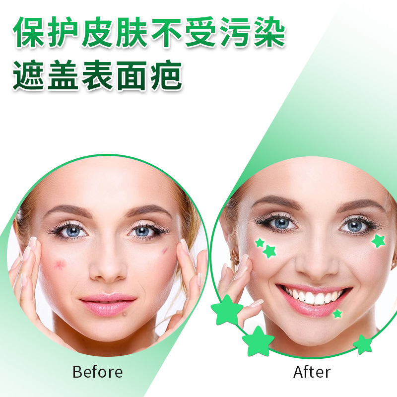 Cross-border night light luminescent acne patch  Irregular pentagram concealer anti-acne patch Light and breathable pimple patch 