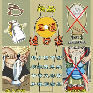 ��ͨ��ڴ�һ��ʽ����ʽ�쯛���������������·��Ostomy