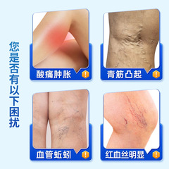 Varicose Vein Type Medical Fever Reducing Gel 20g Leg Vein Swelling Worm-like Blue Veins Prominent Ointment Wholesale