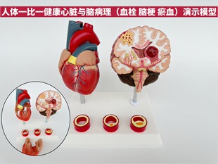 Human cardiovascular and cerebrovascular display model blood pressure hyperemia heart mold and cardiovascular model comparison teaching aids model