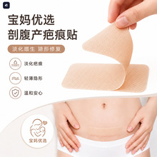 医用级硅酮疤痕贴剖腹产术后伤疤护理增生疤痕疙瘩硅凝胶疤痕贴