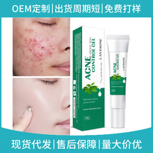 羳Ʒ޸沿ȥͷ۴acne gel