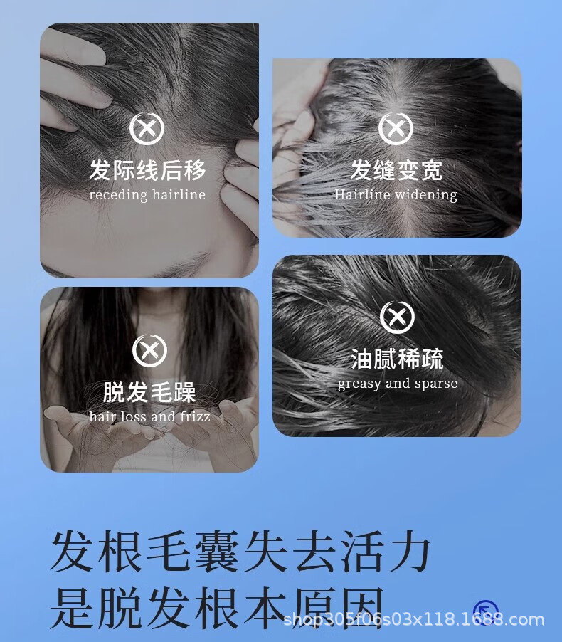EHD防脱防断固发洗发水生姜育发修护蓬松柔顺丝柔防断发护发素-阿里巴巴
