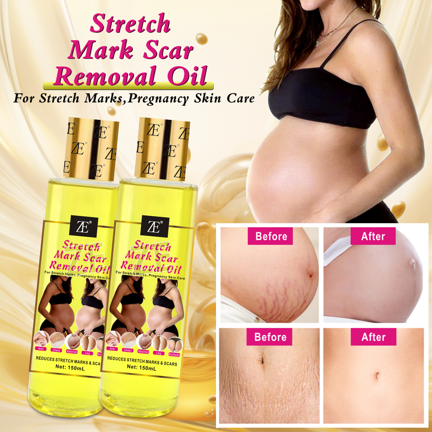 Cross-border stretch marks oil postpartum repair firming oil moisturizing pregnant women desalination melanin massage essential oil 150ml