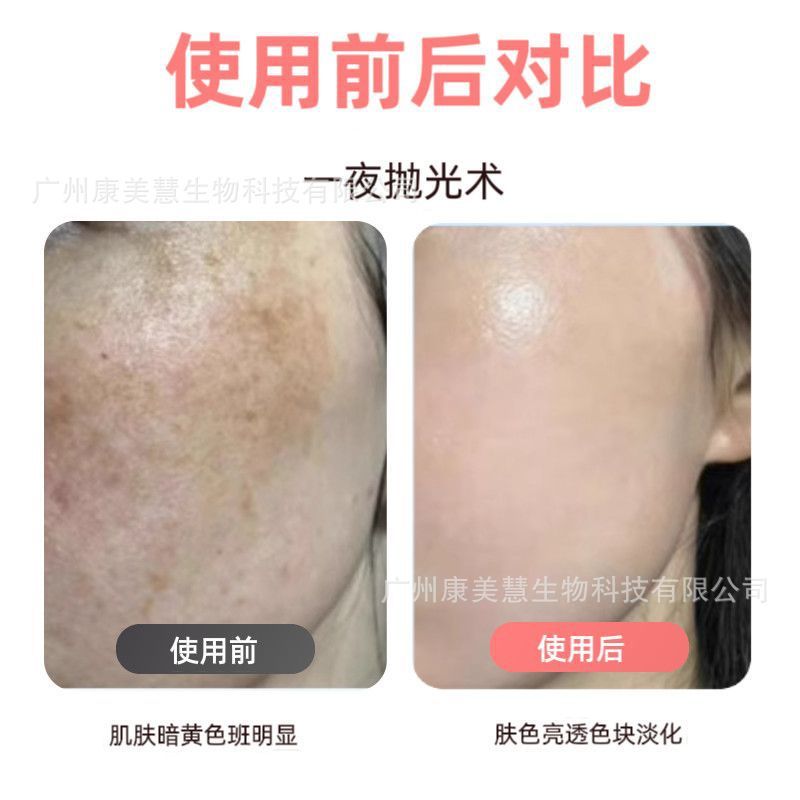 新品断黑因子冻干粉黑色素细胞阻断液美容院脸部拓客精华液厂家|undefined