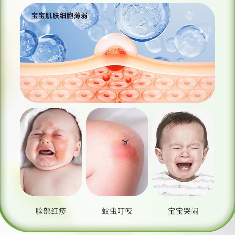 Nobixing ベビースキンケアクリーム 抗菌クリーム 赤ちゃんの肌の外用ケア軟膏 リソスペルマム軟膏 おむつクリーム|undefined