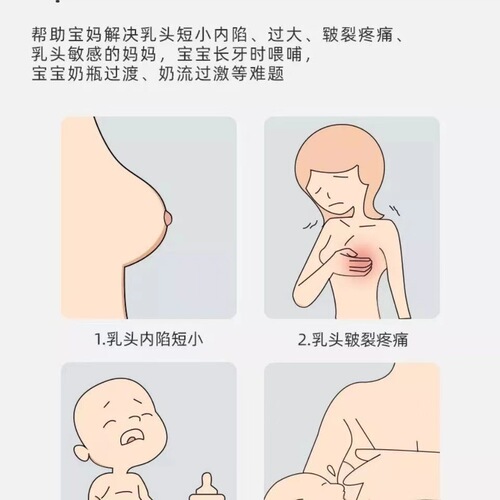 Linda Mommy Nipple Protector Ultra-thin Inverted Breastfeeding Auxiliary Nipple Cover Silicone Paste Breast Shield 2 Pack