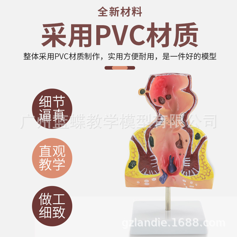 רҵ�ع�ֱ������ģ�� ����ֱ������ģ�� ��¥̽�� �̴�ģ�� ����