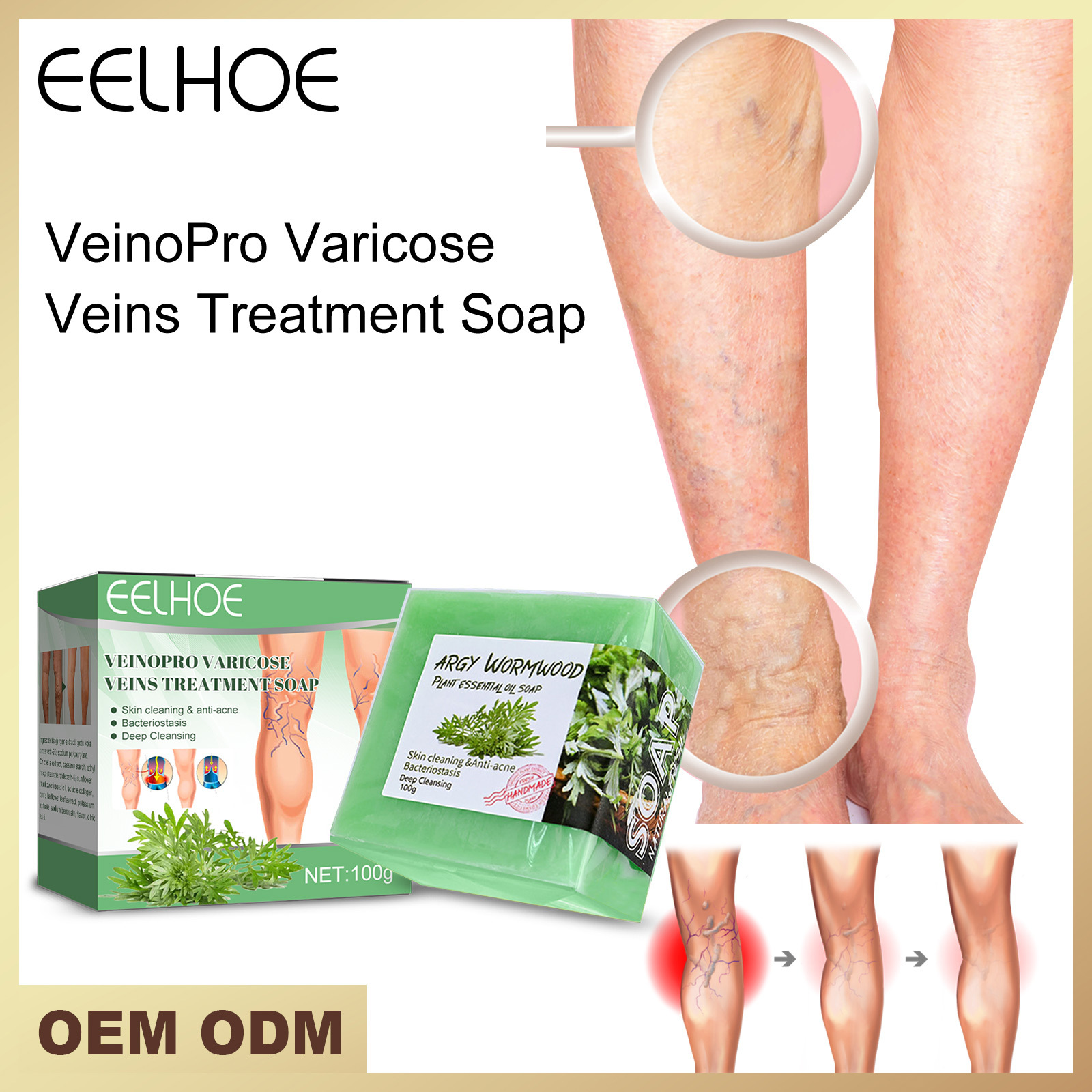 Massaggio endovenoso Eelhoe con sapone per lenire le varici, alleviare le sporgenze nelle gambe dei lombrichi e pulire il polso_voghion.com