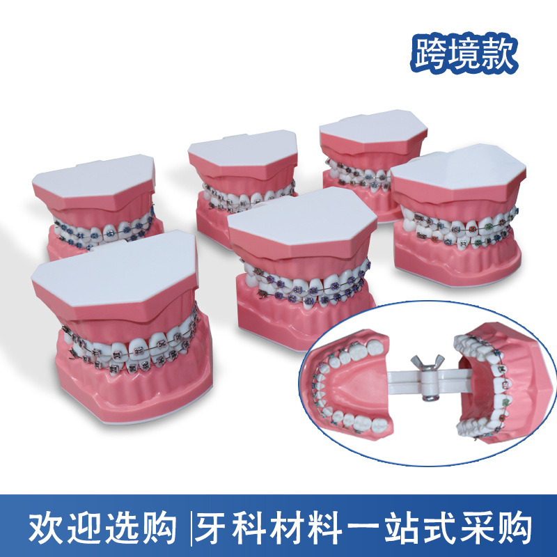 Metal Bracket Interdental Model for Patient-Doctor Communication, 28-Bracket Practice Model, Dental Oral Interdental Correction Model