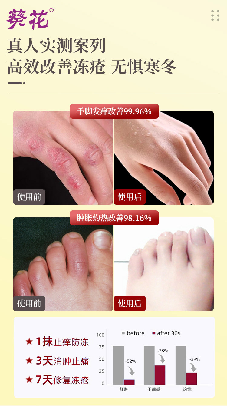 皮肤护理软膏详情2_03