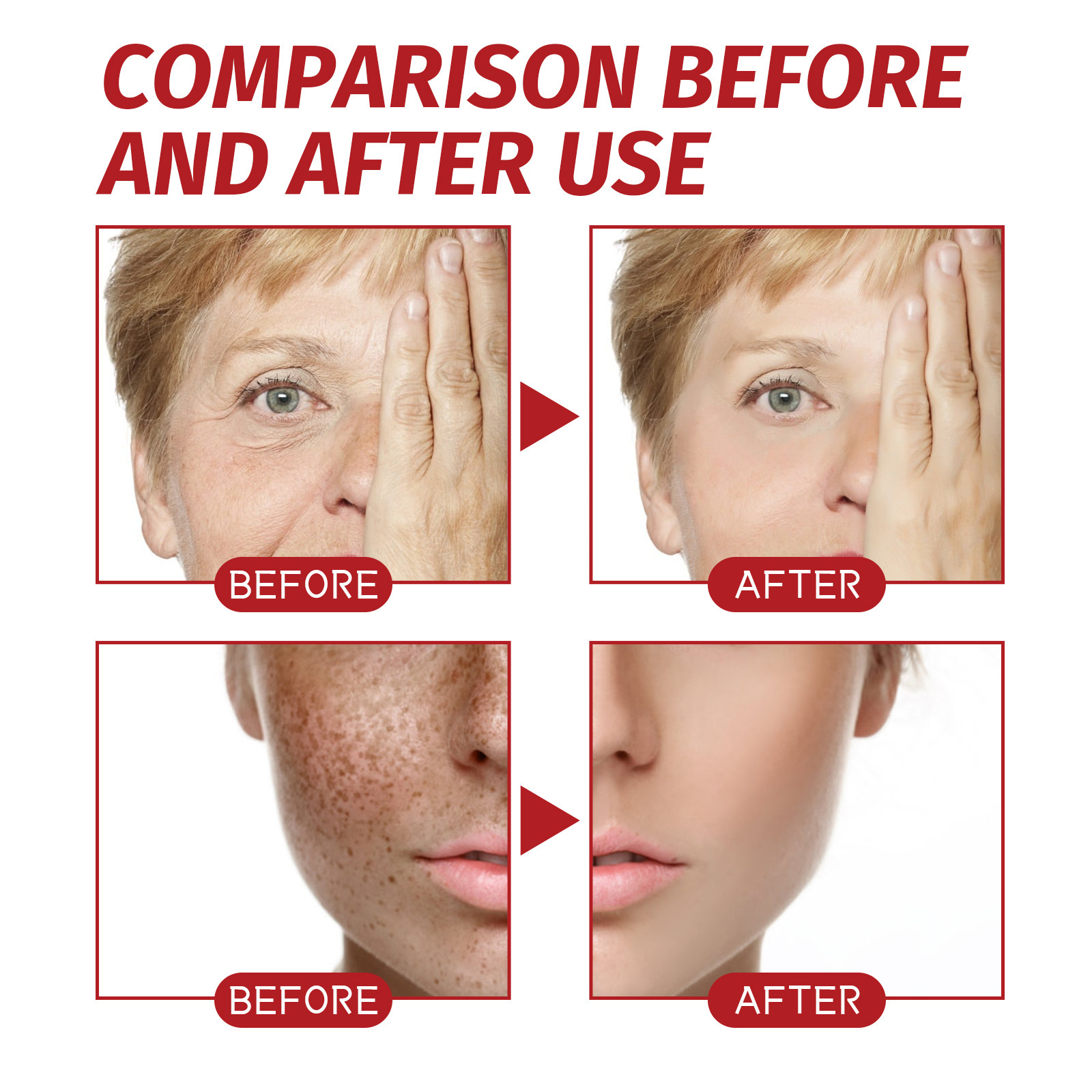 Jayswing kojic acid can lighten spots, repair the dark, white, brighten, wrinkle resistant and rejuvenating face cream_voghion.com