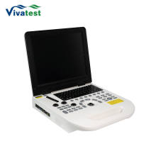 �羳 P20 ȫ���ֵ綯��Яʽ����ɨ���� THI ���� IMT �Զ�����