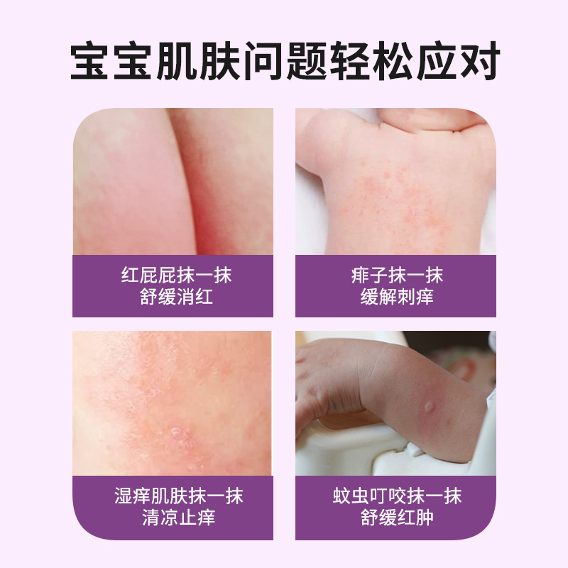 森源赤ちゃん紫草ペースト子供刺された皮膚抗菌クリーム赤ちゃん専用赤尻紫草ペースト|undefined