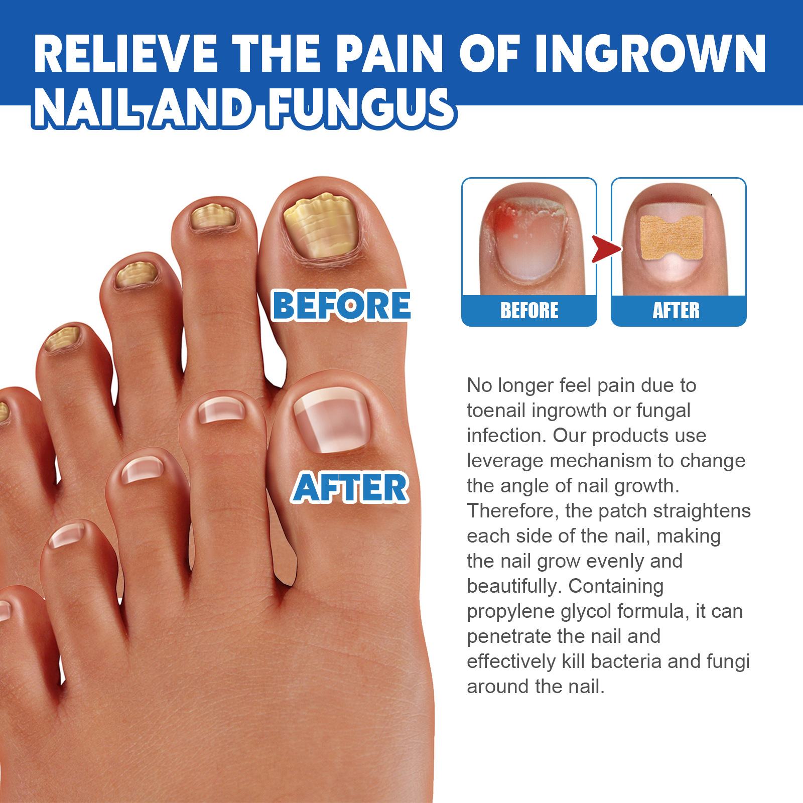 Nail Care Patch Image 11