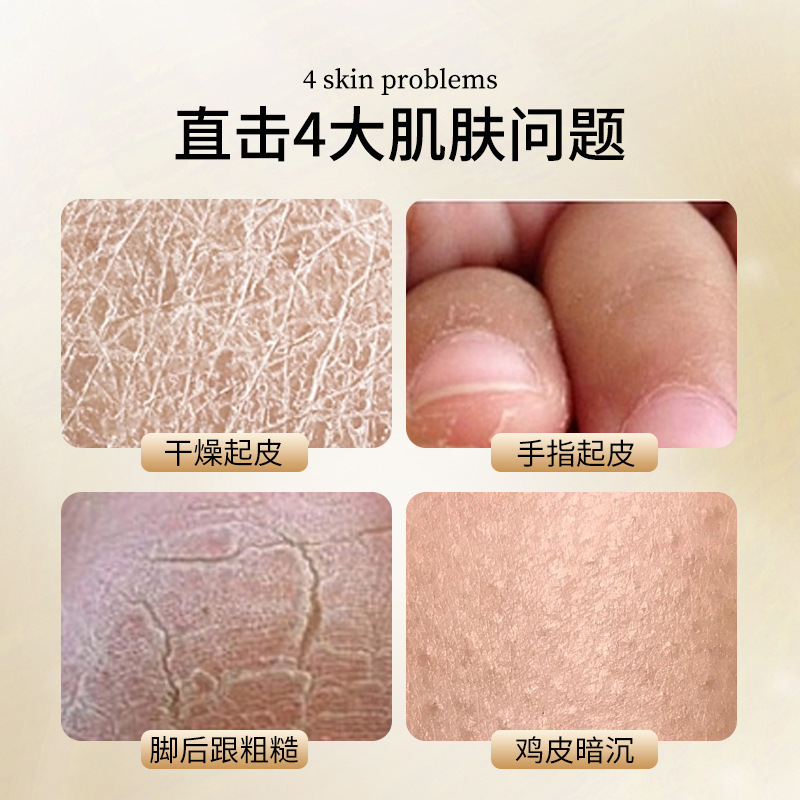 蓝荀止痒润肤露 全身通用皮肤干燥痒起皮秋冬保湿身体乳抖音爆款|undefined