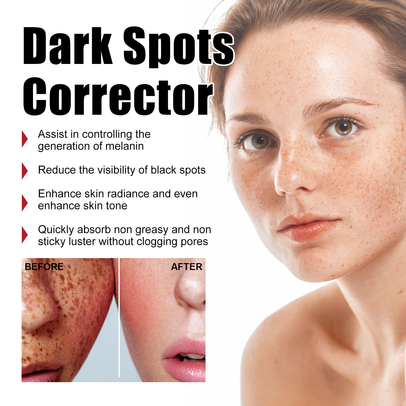 West&Month Spot Correction Cream reparerar ansiktsmörker, svarta fläckar, fräknar, fuktgivande, blekning och_voghion.com