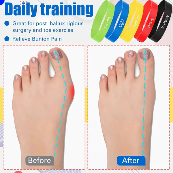 Cross-border thumb valgus exercise strap, valgus toe separator corrector, bunion auxiliary trainer, bunion resistance strap