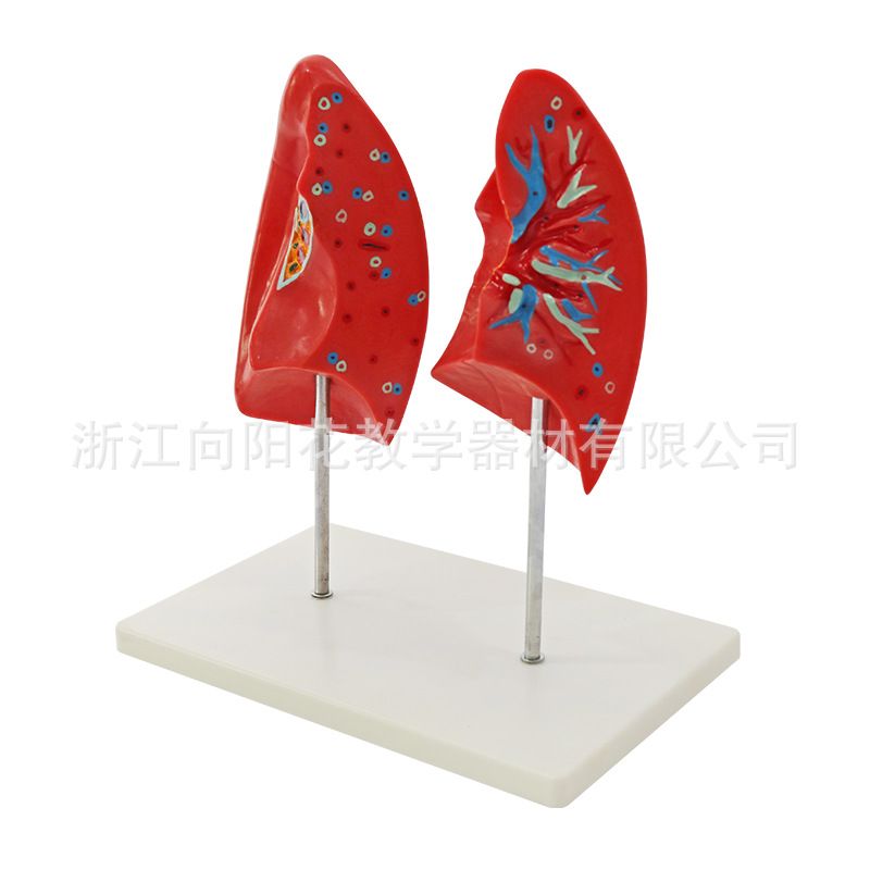 厂家直销 生物医疗生物教学展示模型 SM-M037 双肺肺对比模型