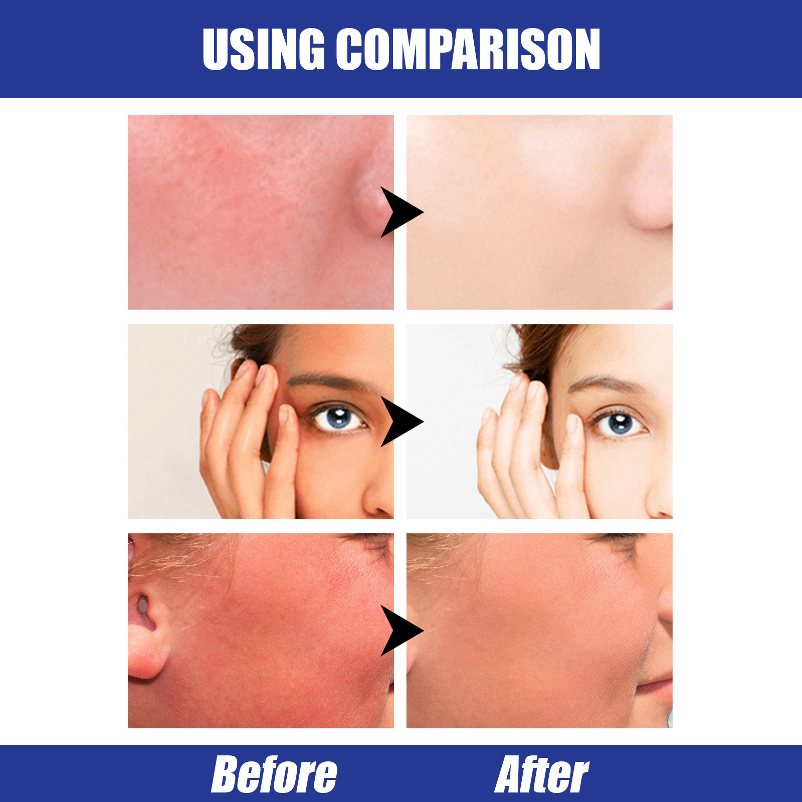 Ράβδος υαλουρονικού οξέος EELHOE Ενυδατώνει ελαφριά, φρέσκια, ενυδατική, απομονωτική, αδιάβροχη, προστασία SPF50+UV_voghion.com