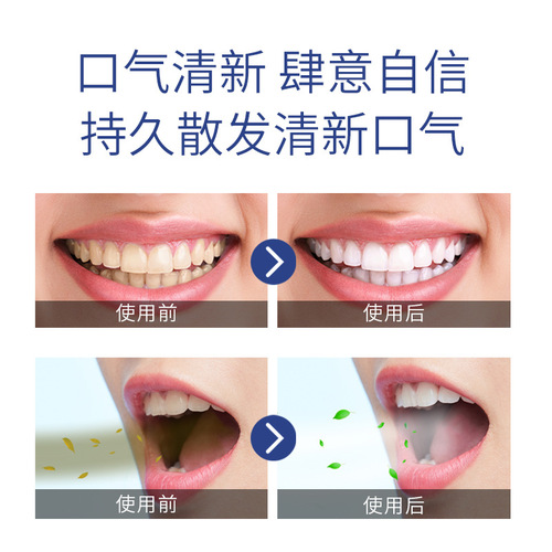 Bingke Disposable Portable Mouthwash Fresh Breath Oral Care for Men and Women 12ml Jelly Cup Mouthwash