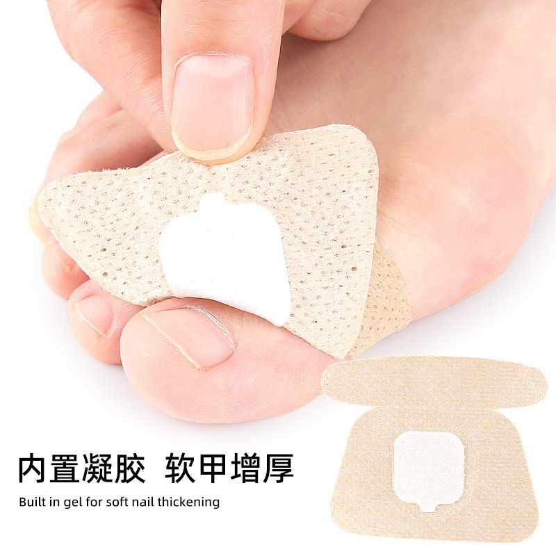 亚马逊水凝胶灰指甲修护贴脚趾甲护理软甲嵌甲增厚甲沟指甲贴片|undefined