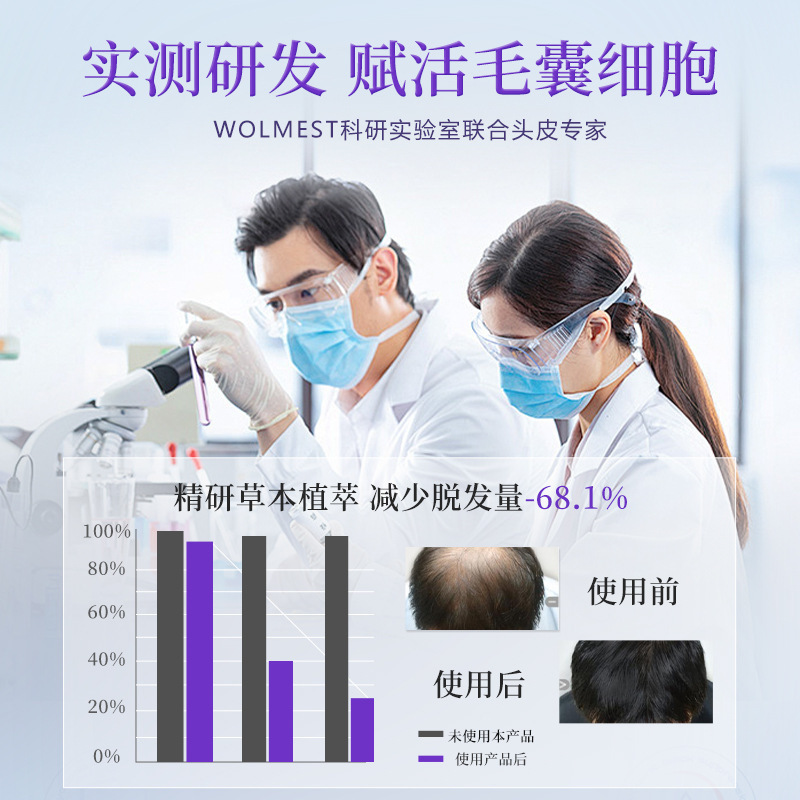 WOLMEST韓国美女鑫防脱シャンプー500ml防脱髪固発育髪純正品コントロール油がふんわりしている|undefined