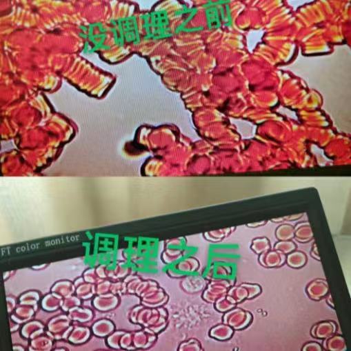 血液浄化健康キットボディケアハーブリンパ循環クレンジング血液排水キットソースメーカー卸売|undefined