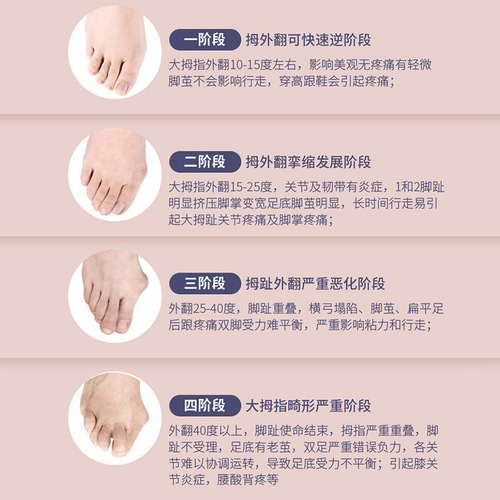 Foot arch trainer, body auxiliary toe corrector, sole function exercise, calf muscle beautification trainer
