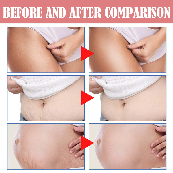 wiieey Medical soft smoothing postpartum massager
