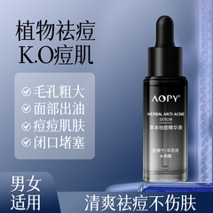AOPY草本のニキビ除去精華液は顔のニキビ筋のにきびを改善します。