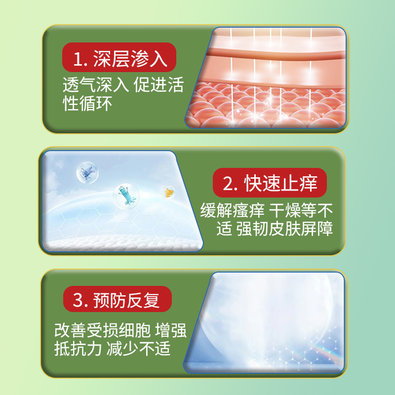 牛皮藓保健液皮肤不适瘙痒小包外用保健液喷剂护理液牛皮藓喷雾|undefined