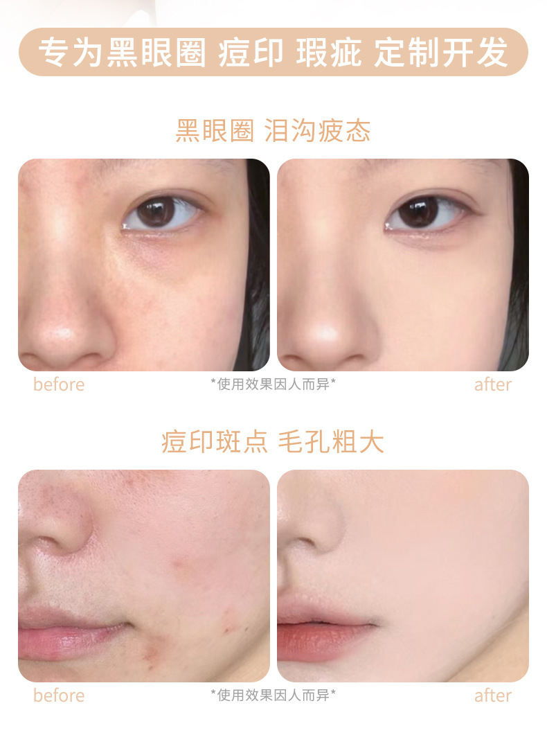 xixi Long-lasting and Penetrating Four-color Concealer covers dark circles, acne marks, facial spots, brightening and contouring concealer palette Application Scenario