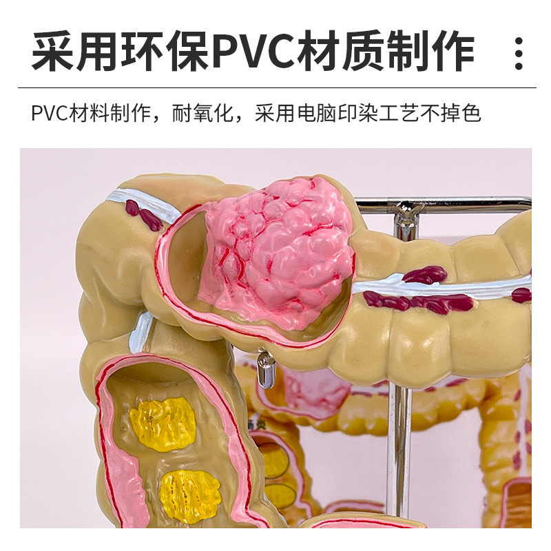 ��ѧ��������󳦲���ģ�ͳ�θֱ���̴�������ʳ��������᳦����