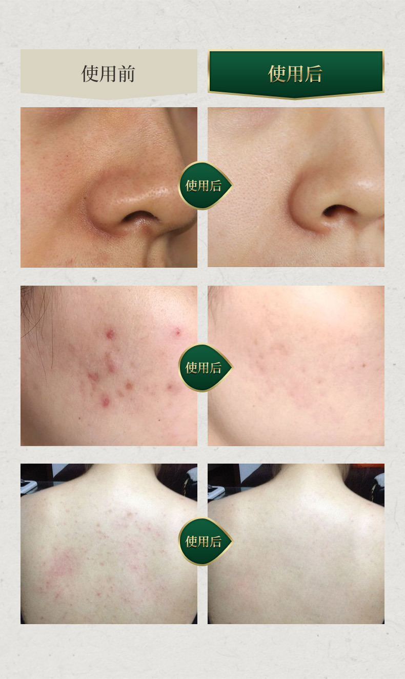 Details picture_11