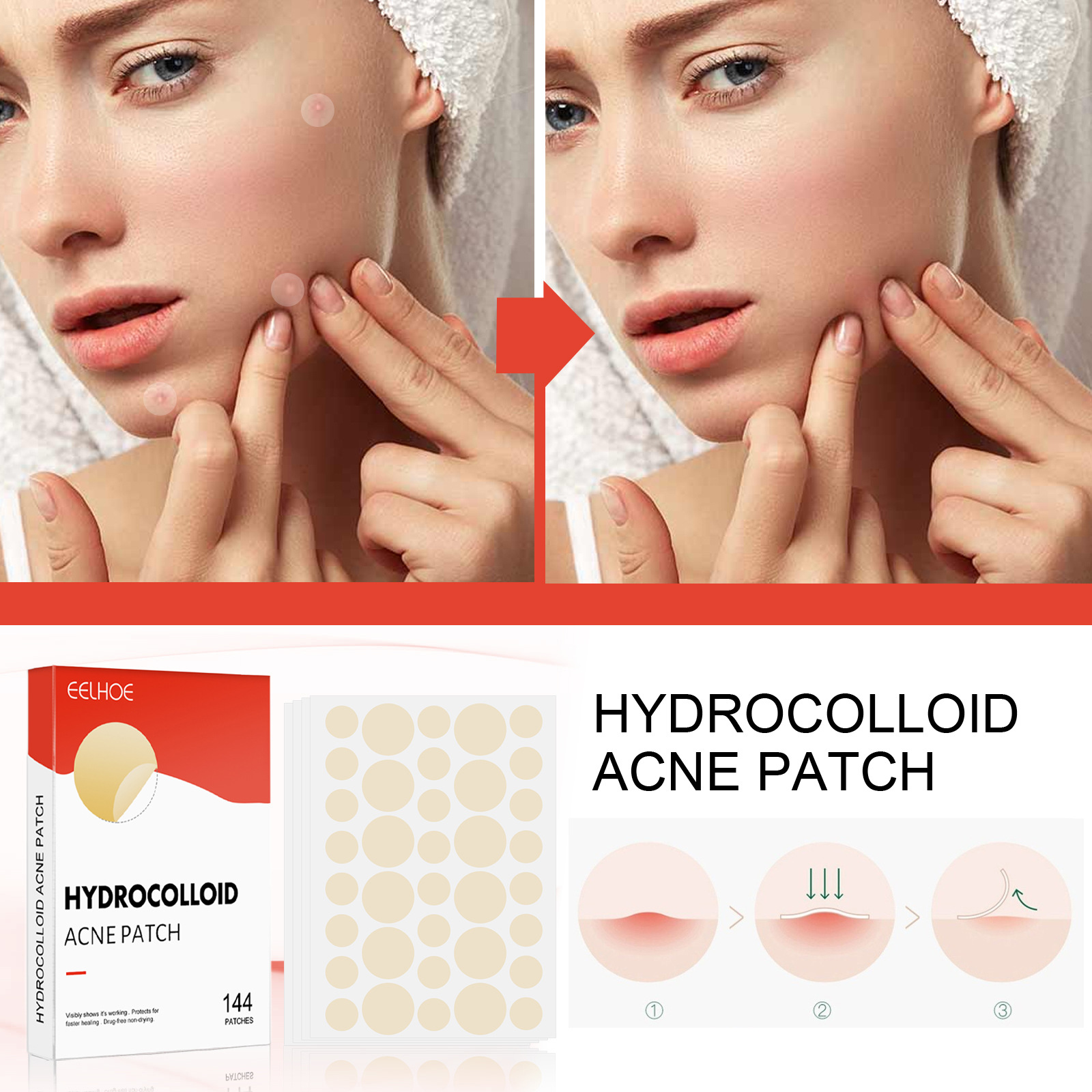 EELHOE Hydrocolloid Acne Patch Facial Invisible Closed Acne Patch Cleans Acne Waterproof Breathable Acne Skin Repairing Patch