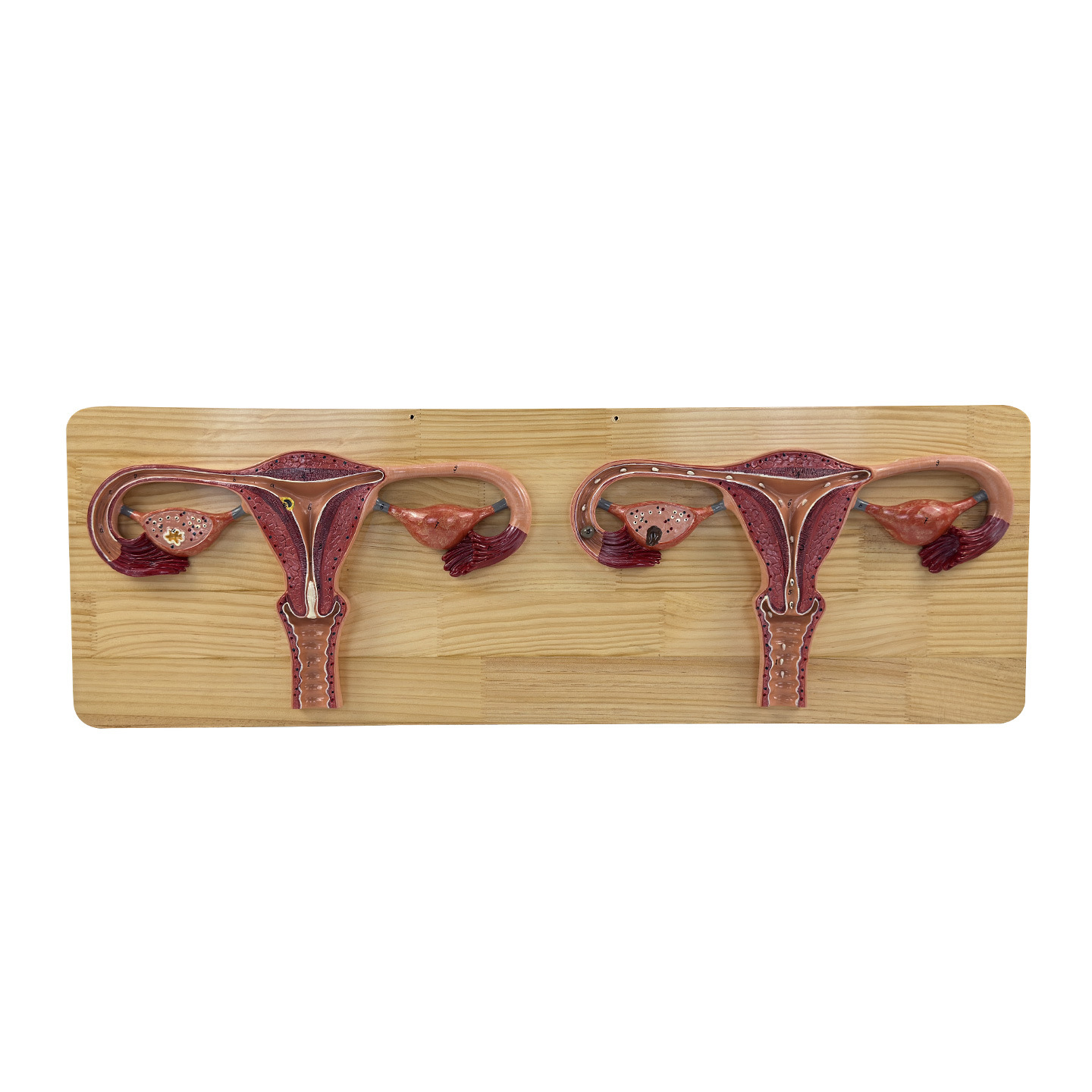 ҽ�������ܾ����̷Ŵ����ģ���ӹ��ѳ��ܾ�����ֳ�Ƽ���չʾģ��