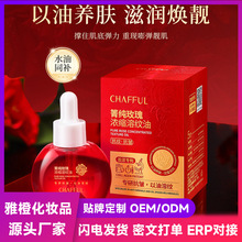 ��ܽ���伃õ���s�ܼy��  ˮ���p�͝���ӯ�������o�w���A��30ml