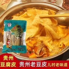 �F�ݶ���Ƥ�~���خaȫ�ɟo�}�ֹ��϶�Ƥ���ʳ�Ķ���Ʒ����������