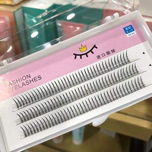 ���潻����ë��Ȼ��ܛ��ë ����׃����Ů�δ�A�ͼ޽Ӷ�ë�ٽ�ë