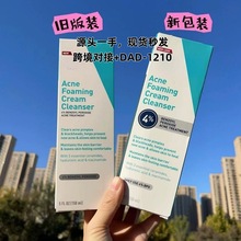 适乐祛痘洁面深层抗痘4%过氧化苯甲酰深层洁面洗面奶150ml